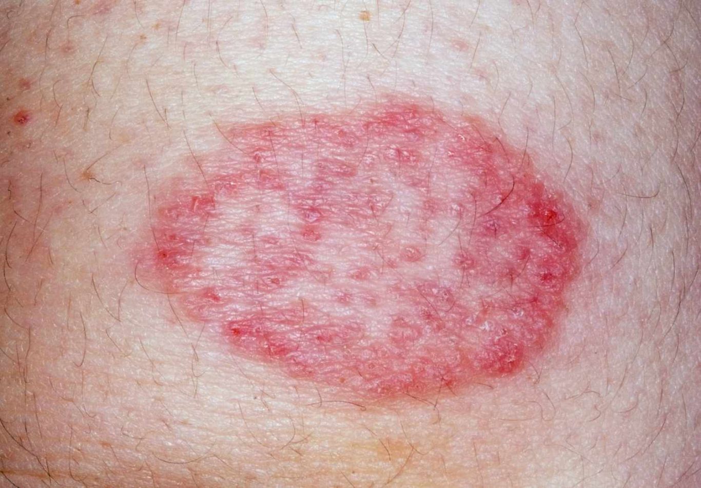 Các bệnh lý ở da thường gặp