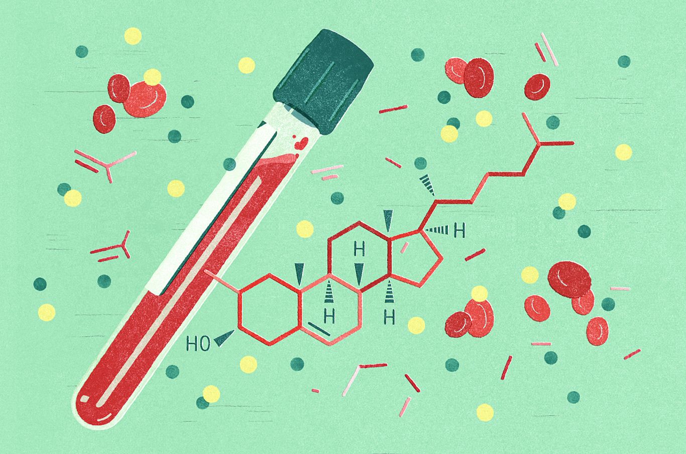 HDL cholesterol