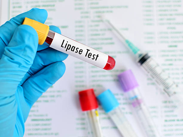 xét nghiệm lipase