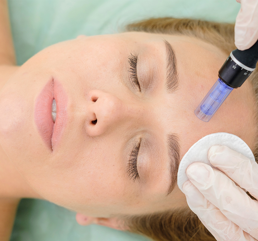 mesotherapy là gì