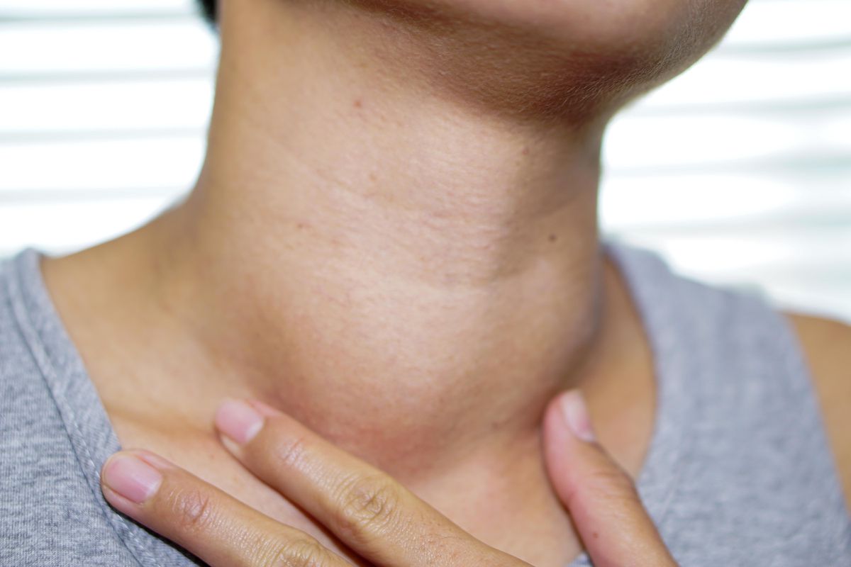 xét nghiệm kiểm tra tuyến giáp