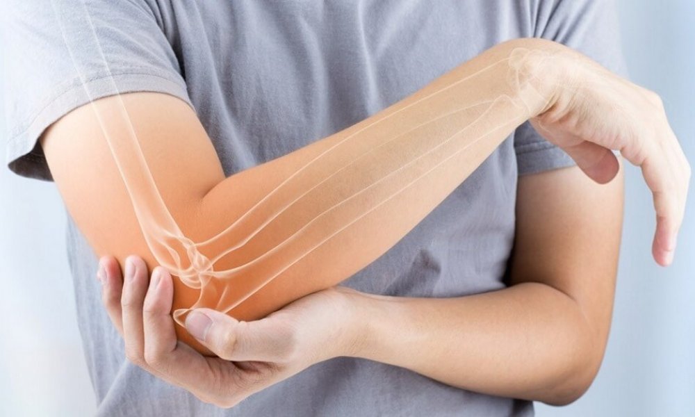 hội chứng tenis elbow
