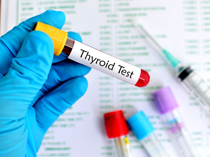xét nghiệm hormone tuyến giáp