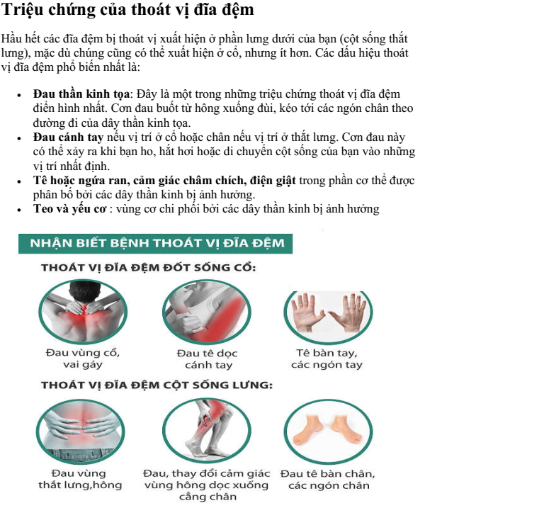 triệu chứng của thoát vị đĩa đệm