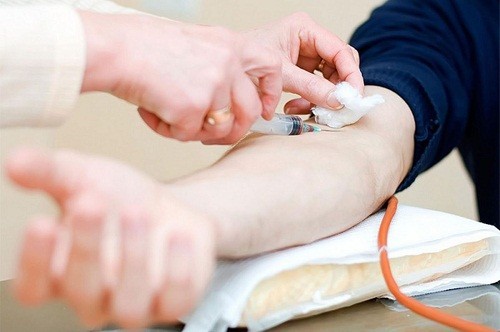 chuẩn bị khi xét nghiệm chức năng gan