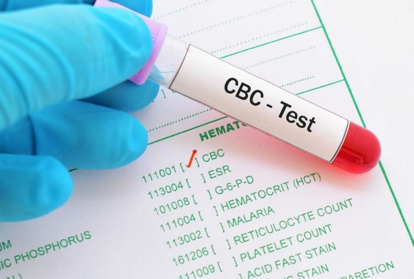 xét nghiệm công thức máu