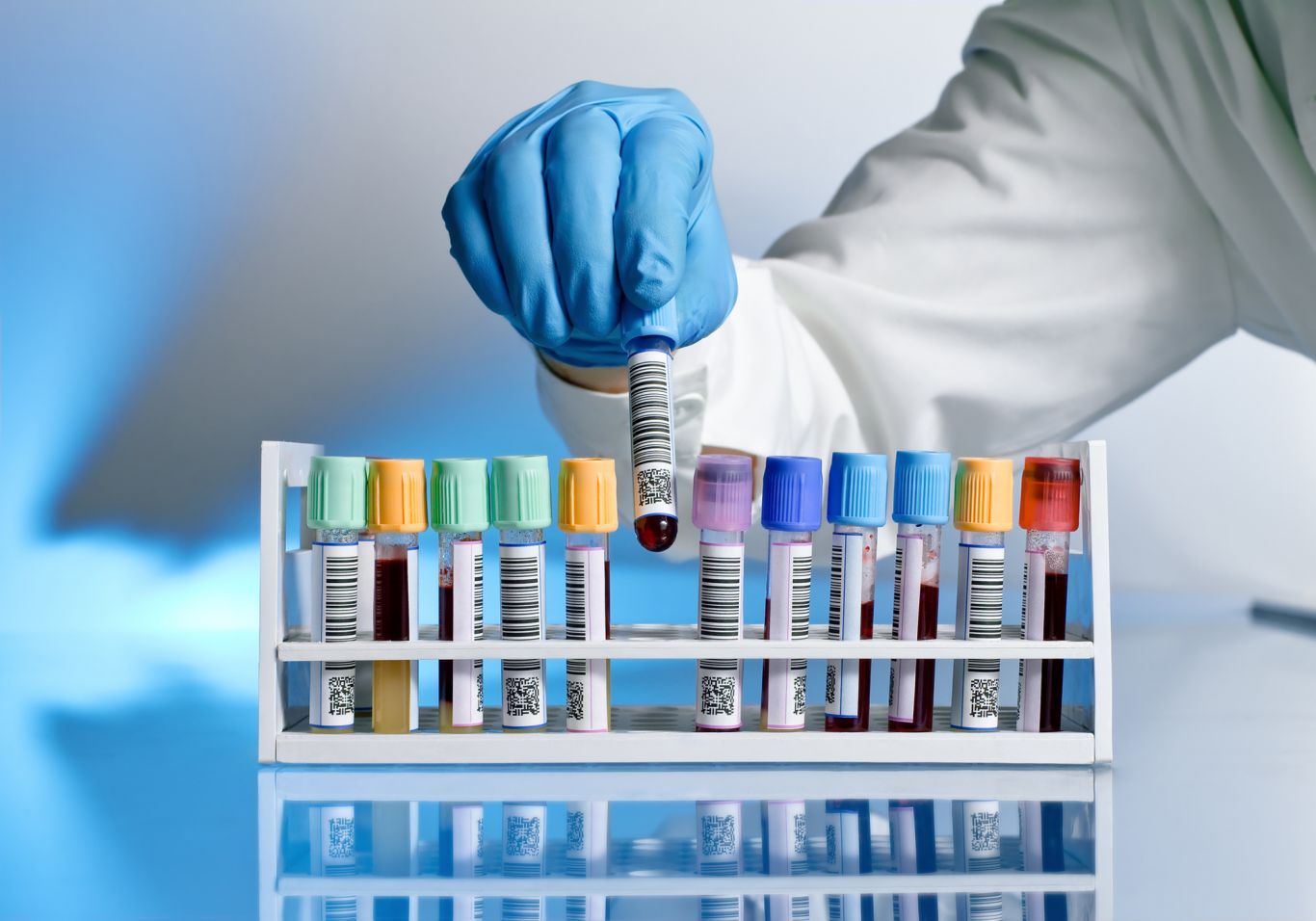 xét nghiệm hormone tuyến giáp